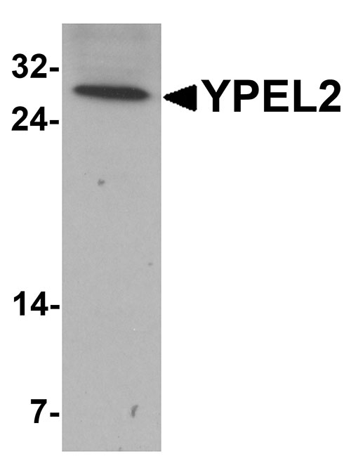 1 - YPEL2 Antibody ASC11457