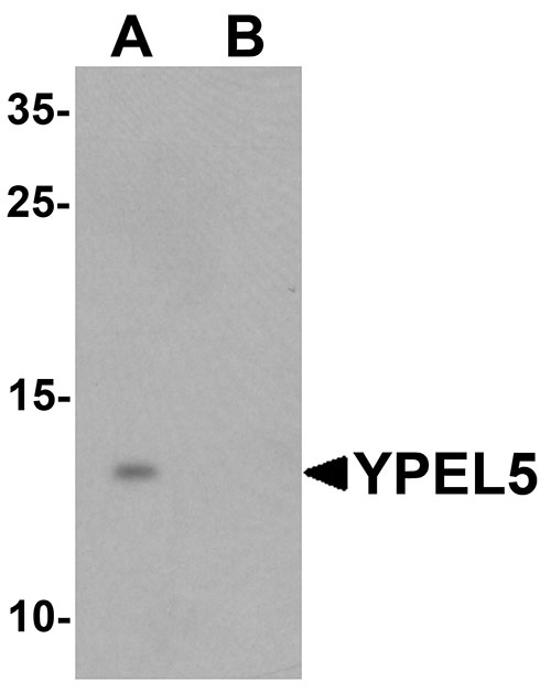 1 - YPEL5 Antibody ASC11460