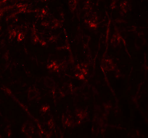 3 - TMEM106A Antibody ASC11461