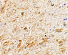 2 - TMEM106A Antibody ASC11461