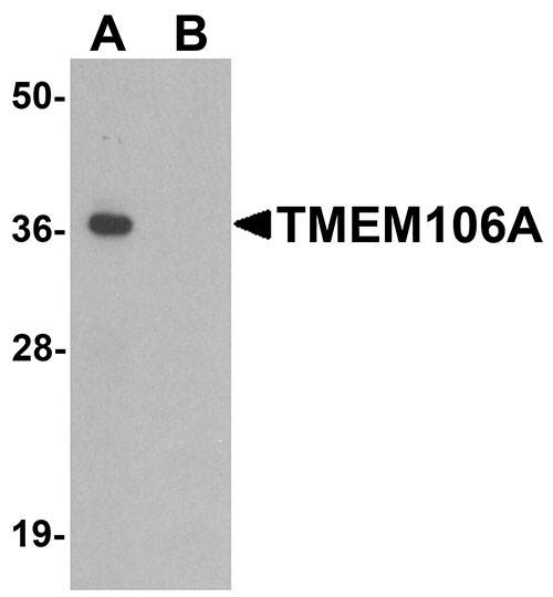 1 - TMEM106A Antibody ASC11461