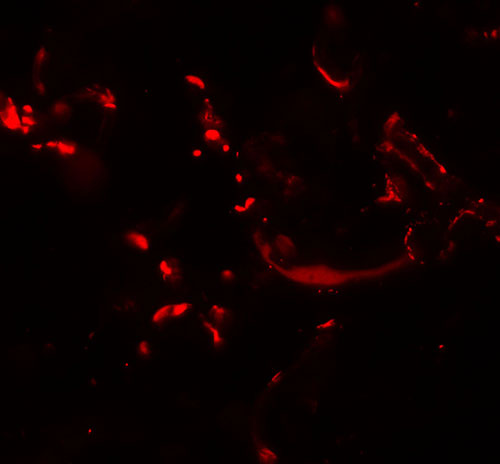 3 - HHATL Antibody ASC11464