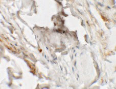 2 - HHATL Antibody ASC11464
