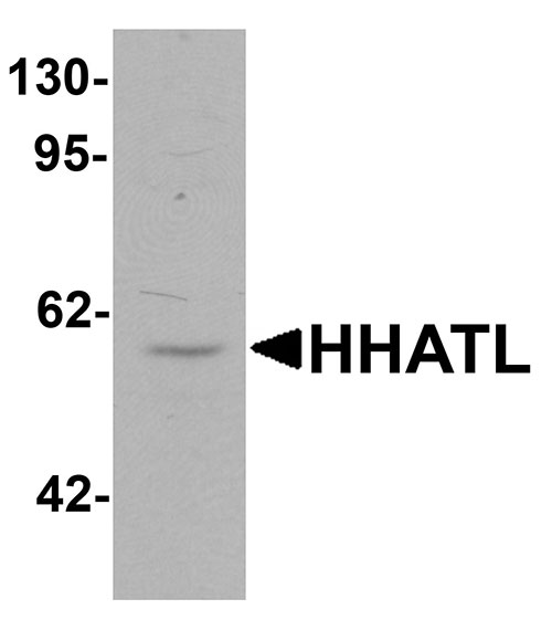 1 - HHATL Antibody ASC11464