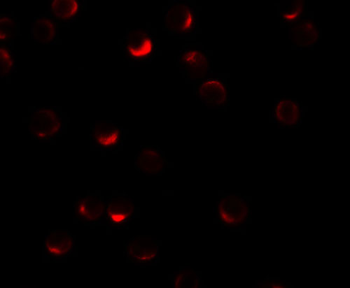 3 - RILP Antibody ASC11466
