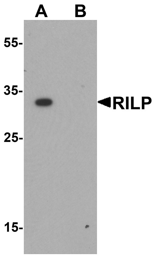 1 - RILP Antibody ASC11466