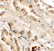 2 - GZF1 Antibody ASC11467