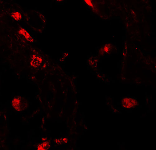 3 - RLP2 Antibody ASC11469