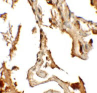2 - RLP2 Antibody ASC11469
