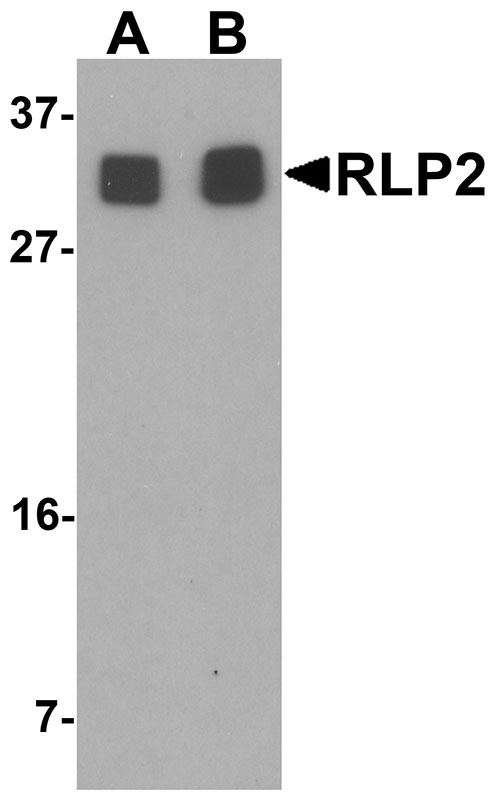 1 - RLP2 Antibody ASC11469