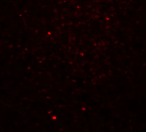 3 - CLEC7A Antibody ASC11480