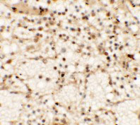 2 - CLEC7A Antibody ASC11480
