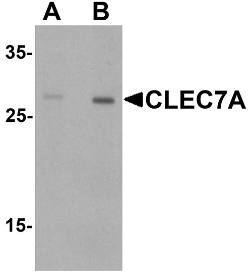 1 - CLEC7A Antibody ASC11480