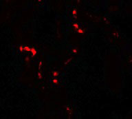 3 - THBS4 Antibody ASC11484