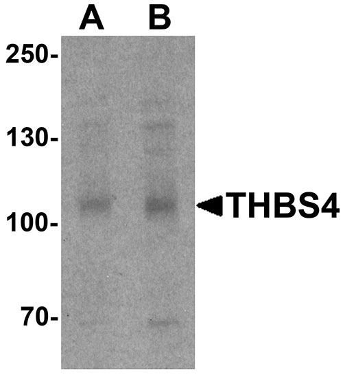 1 - THBS4 Antibody ASC11484