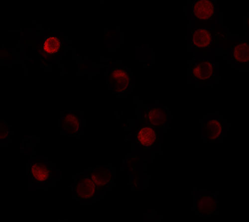 3 - ZNF521 Antibody ASC11486