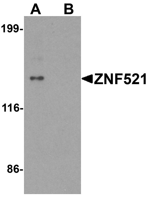 1 - ZNF521 Antibody ASC11486