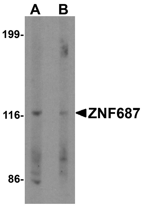 1 - ZNF687 Antibody ASC11487