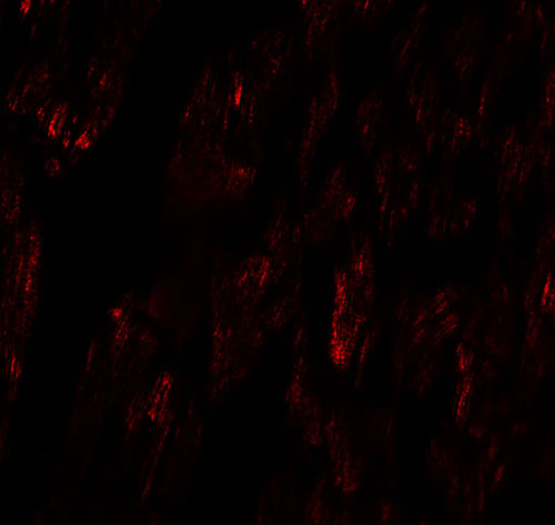 3 - FCHO2 Antibody ASC11488