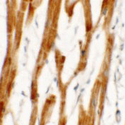2 - FCHO2 Antibody ASC11488