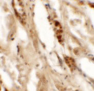 2 - DBX2 Antibody ASC11489