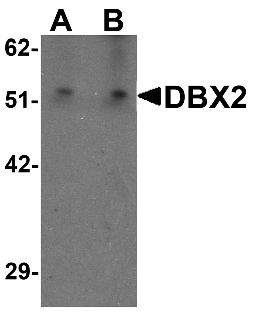 1 - DBX2 Antibody ASC11489