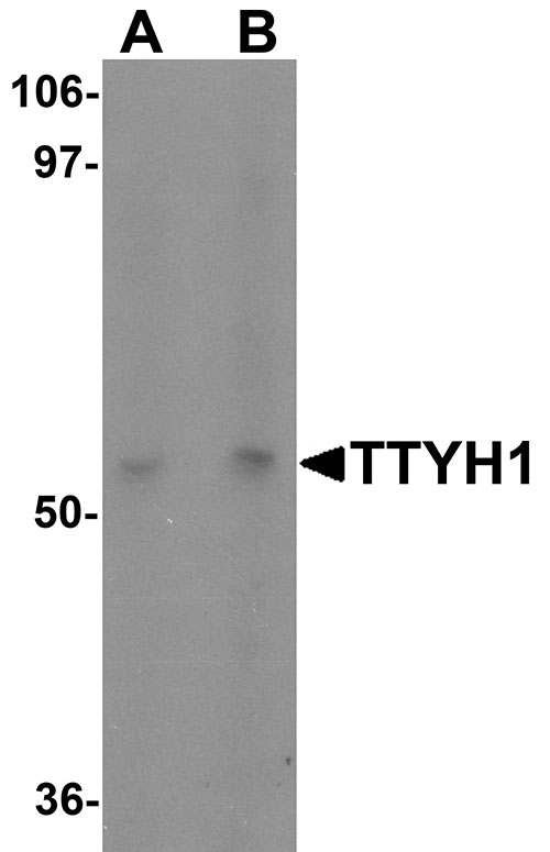 1 - TTYH1 Antibody ASC11492
