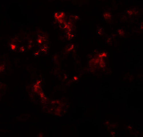 3 - TTYH2 Antibody ASC11493