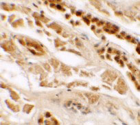 2 - TTYH2 Antibody ASC11493