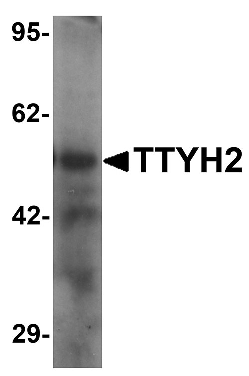 1 - TTYH2 Antibody ASC11493