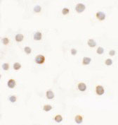 8 - ABCA7 Antibody ASC11494