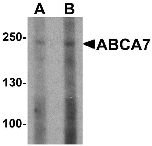 1 - ABCA7 Antibody ASC11494