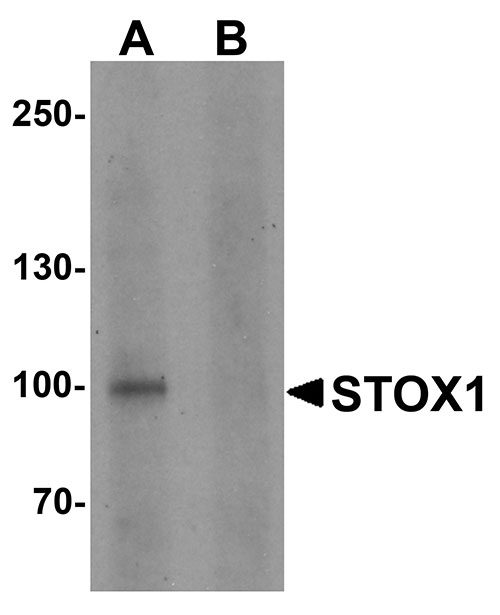 1 - STOX1 Antibody ASC11496