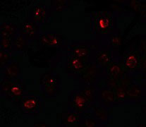 3 - ZBTB40 Antibody ASC11498