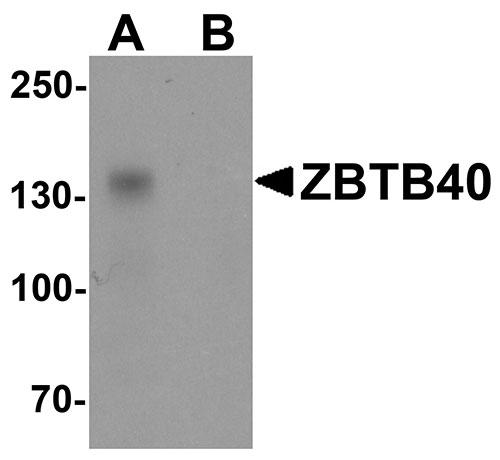 1 - ZBTB40 Antibody ASC11498