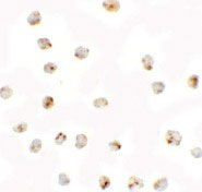8 - BMP15 Antibody ASC11499