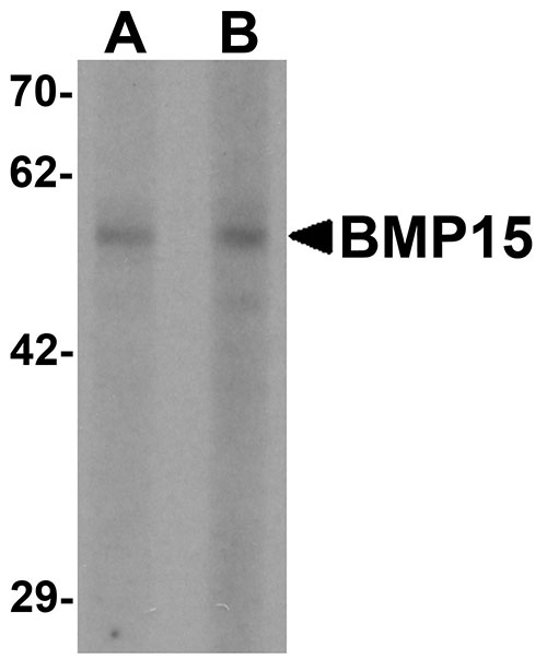 1 - BMP15 Antibody ASC11499