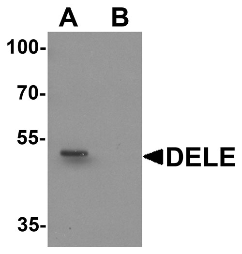 1 - DELE Antibody ASC11504
