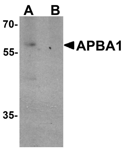 1 - APBA1 Antibody ASC11506