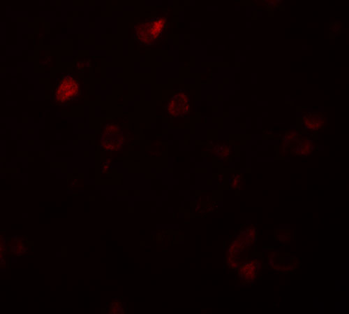 3 - CCDC22 Antibody ASC11510