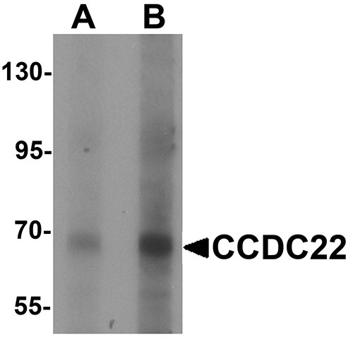 1 - CCDC22 Antibody ASC11510