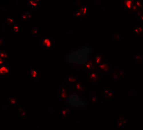 3 - FAM193B Antibody ASC11512