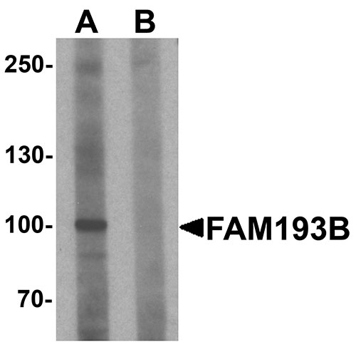 1 - FAM193B Antibody ASC11512
