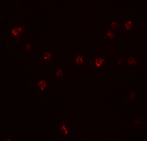3 - DDX60 Antibody ASC11514