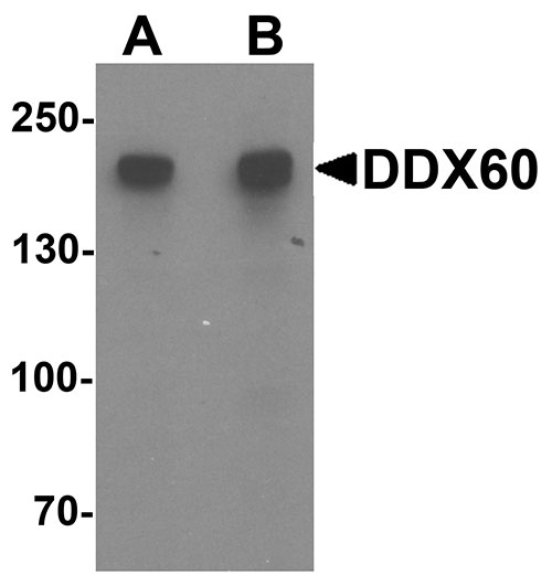 1 - DDX60 Antibody ASC11514