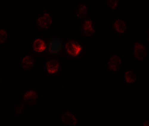3 - TCTEX1D1 Antibody ASC11516