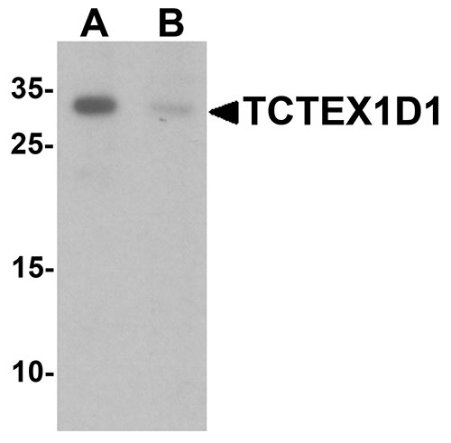 1 - TCTEX1D1 Antibody ASC11516