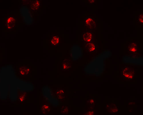3 - TCTEX1D2 Antibody ASC11517