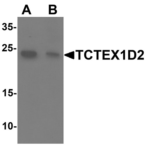 1 - TCTEX1D2 Antibody ASC11517