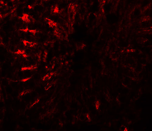 3 - TCTEX1D3 Antibody ASC11518